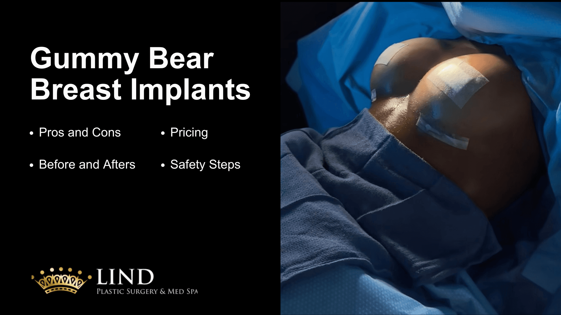 Gummy Bear Implants: Pros and Cons, Cost, Before/After Images