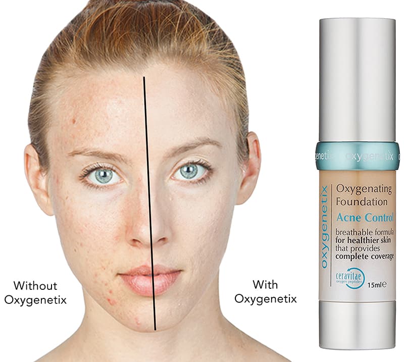 Oxygenetix Before & After 2